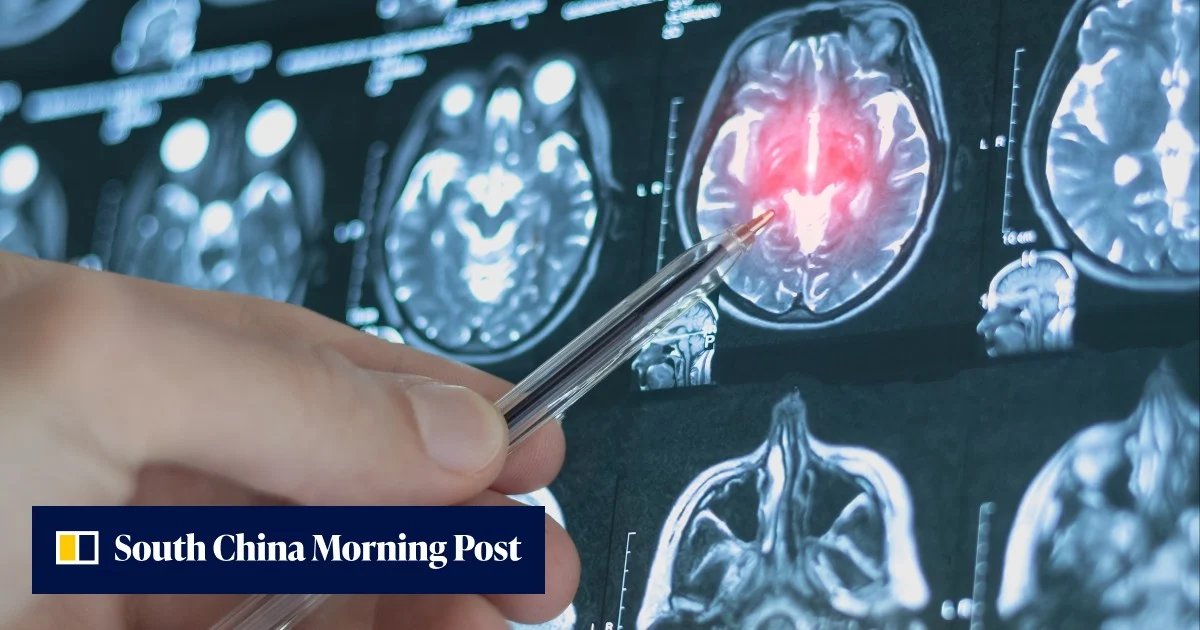 Çinli Bilim İnsanları Depresyon Riskini 4 Yıl Önceden Tahmin Eden AI Geliştirdi