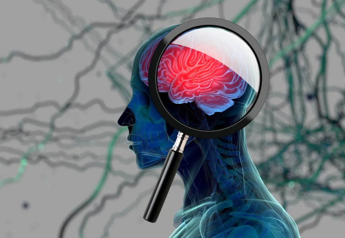 Uyku Testi, Alzheimer'ı Erken Tespit Etmeye Yardımcı Olabilir